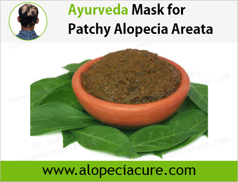 Ayurveda Mask for Alopecia Areata